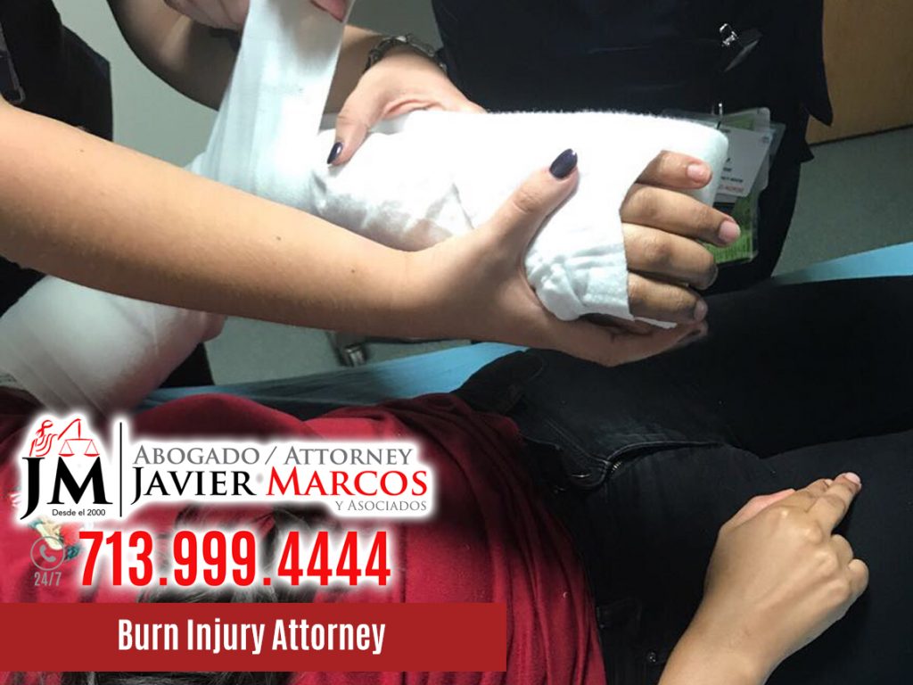 Burn Injury Attorney | Attorney Javier Marcos | 713.999.4444