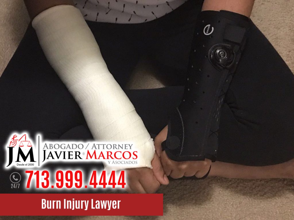 Burn Injury Lawyer | Attorney Javier Marcos | 713.999.4444