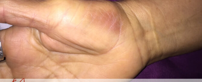 Injured at work | Attorney Javier Marcos | 713.999.4444