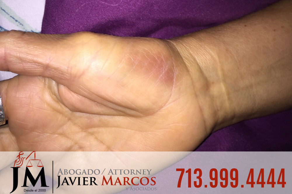 Injured at work | Attorney Javier Marcos | 713.999.4444