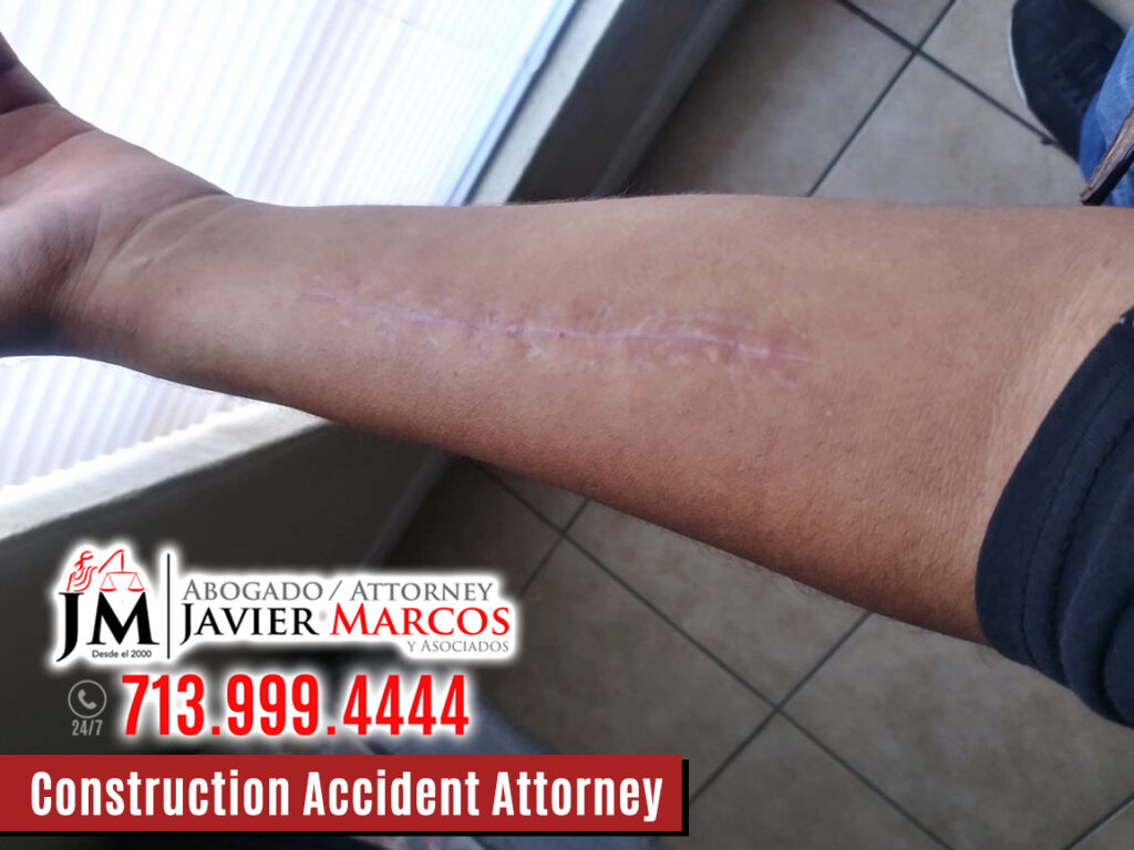 Construction Accidents Attorney | Attorney Javier Marcos | 713.999.4444