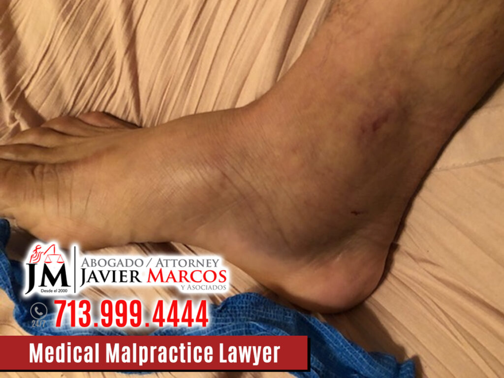 Medical Malpractice Lawyer | Attorney Javier Marcos | 713.999.4444